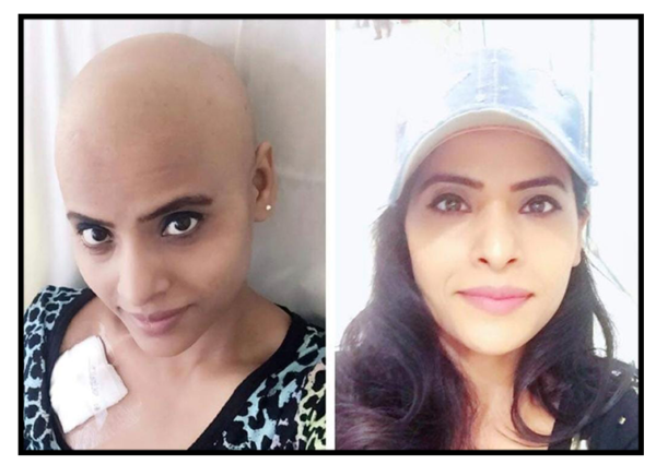 World Cancer Day: Meet Anchal Sharma, a life from struggles to selfless care